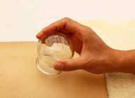 massage ventouse toulouse